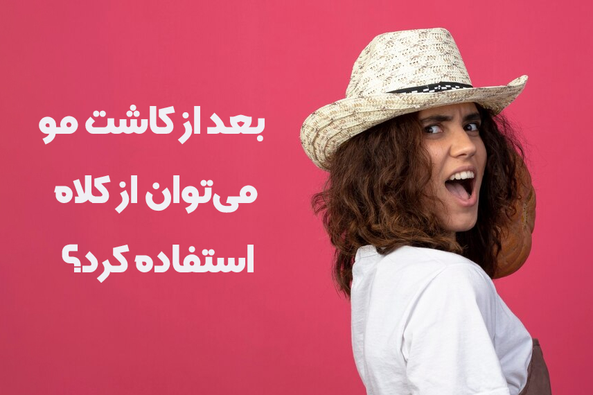 کلاه بعد از کاشت مو استفاده از کلاه بعد از کاشت مو