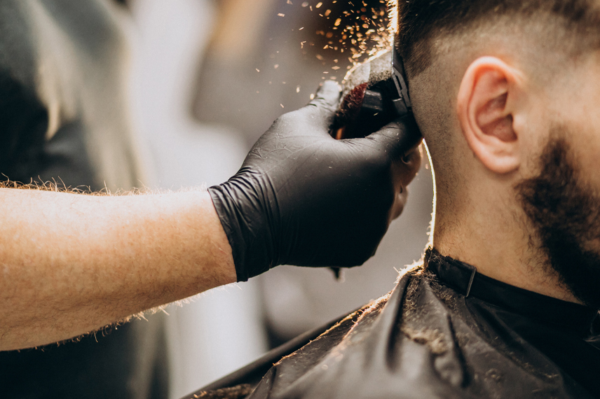 no-shave-hair-transplant