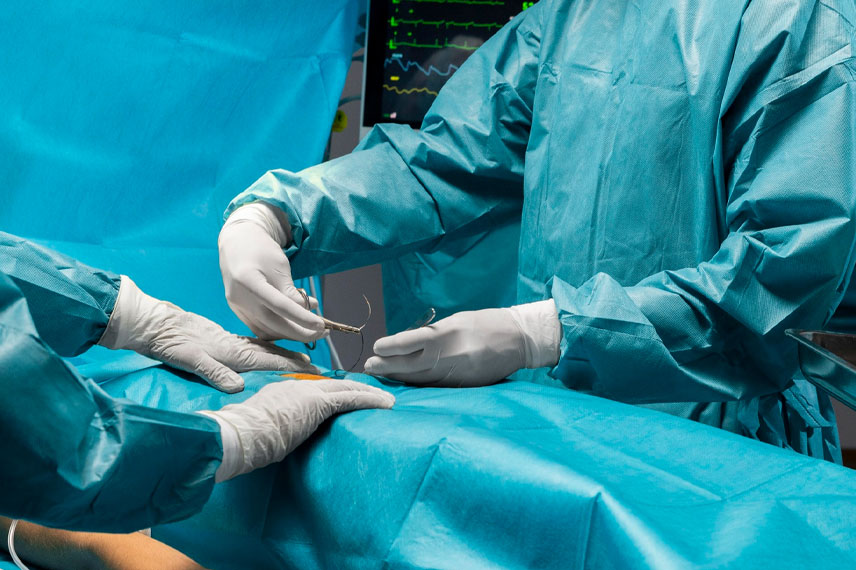 sleeve-gastrectomy-recovery